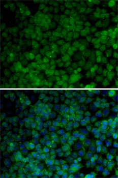 CDK7 Antibody