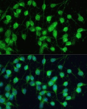 CDK7 Antibody