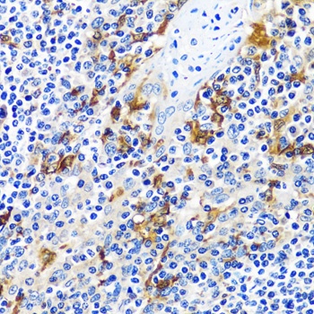 CASQ1 Antibody