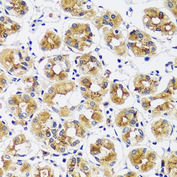 CASQ1 Antibody