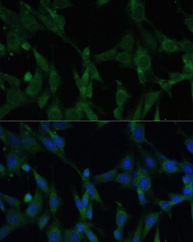CASQ1 Antibody