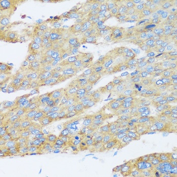 ASGR1 Antibody