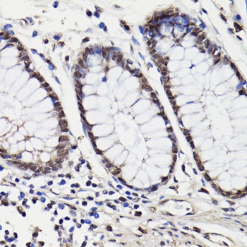 NAV2 Antibody