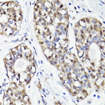 NAV2 Antibody