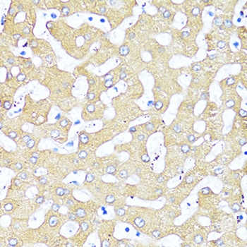 TGFB2 Antibody