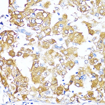 TGFB2 Antibody