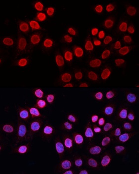 ERCC5 Antibody