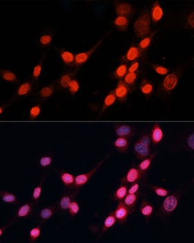 ERCC5 Antibody