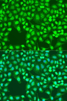 DEFB126 Antibody