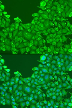 BMP2 Antibody