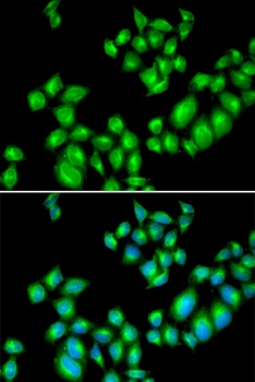 DRD3 Antibody