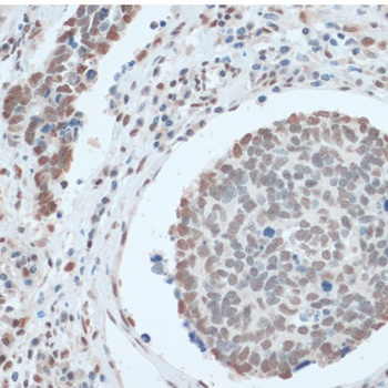 ZNF433 Antibody