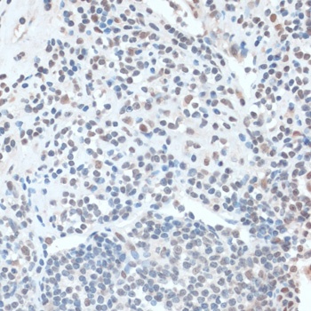 ZNF433 Antibody