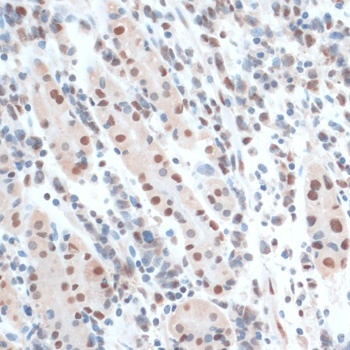 ZNF433 Antibody