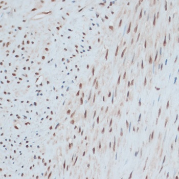 ZNF433 Antibody