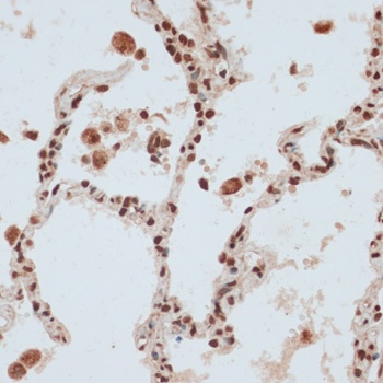 ZNF574 Antibody