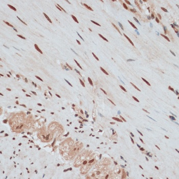 ZNF574 Antibody