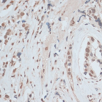 ZNF574 Antibody