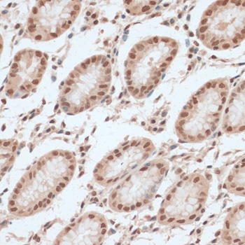 ZNF574 Antibody