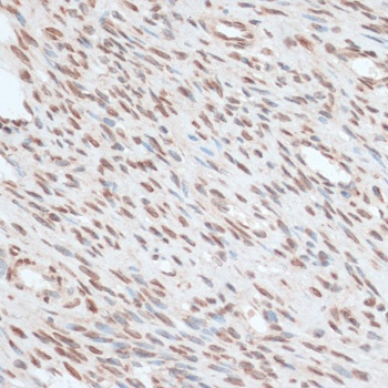 ZNF574 Antibody