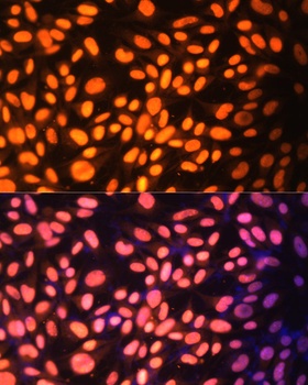 ZNF574 Antibody