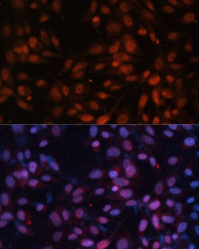 ZNF574 Antibody