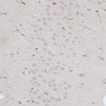 ZNF415 Antibody