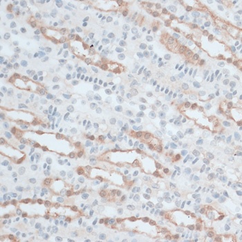 ZNF415 Antibody