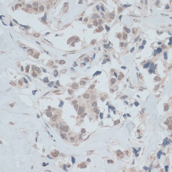 ZNF446 Antibody