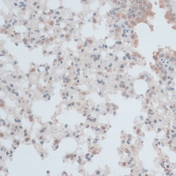 ZNF446 Antibody