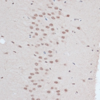 ZNF446 Antibody