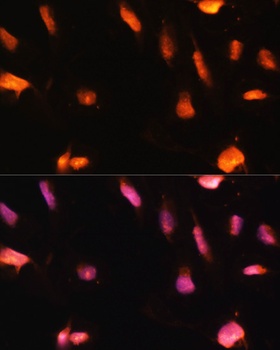 ZNF416 Antibody