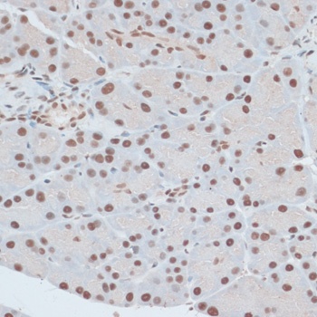 ZNF416 Antibody