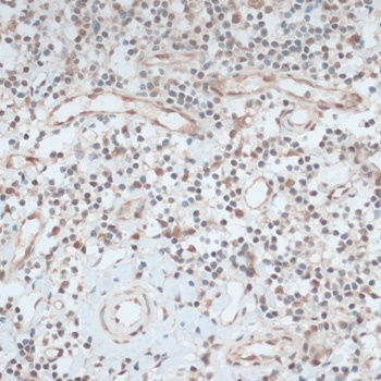 ZNF416 Antibody