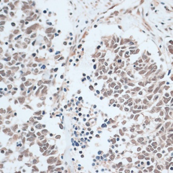 ZNF416 Antibody