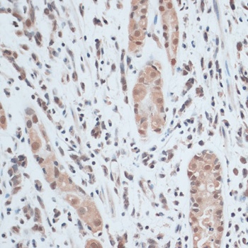 ZNF416 Antibody