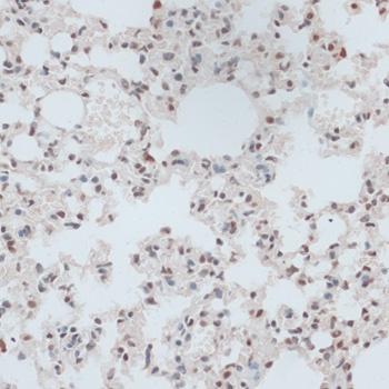 ZNF416 Antibody