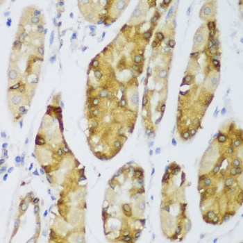 ZNF416 Antibody