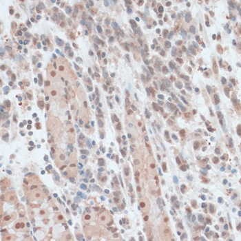 ZNF562 Antibody
