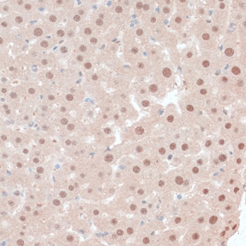 ZNF562 Antibody