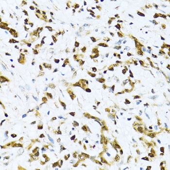 ITGB3BP Antibody