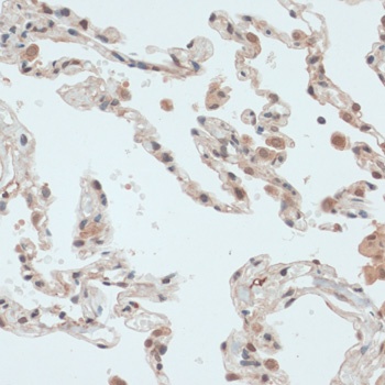 ZNF177 Antibody