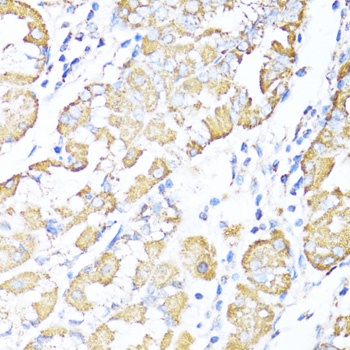 ALDH6A1 Antibody