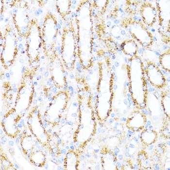 ALDH6A1 Antibody