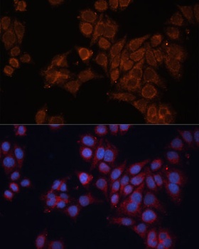 ALDH6A1 Antibody