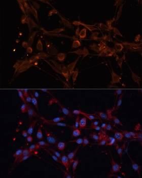 ALDH6A1 Antibody