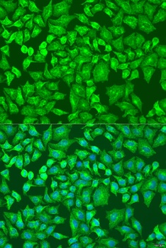 DVL2 Antibody