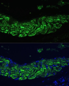 ALOX12 Antibody