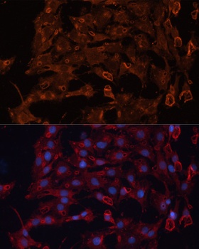 ABCB11 Antibody