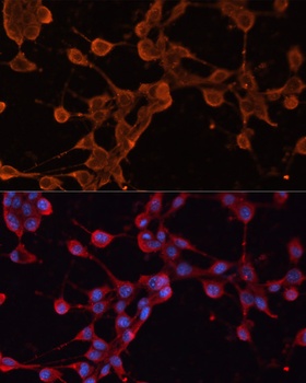 ABCB11 Antibody